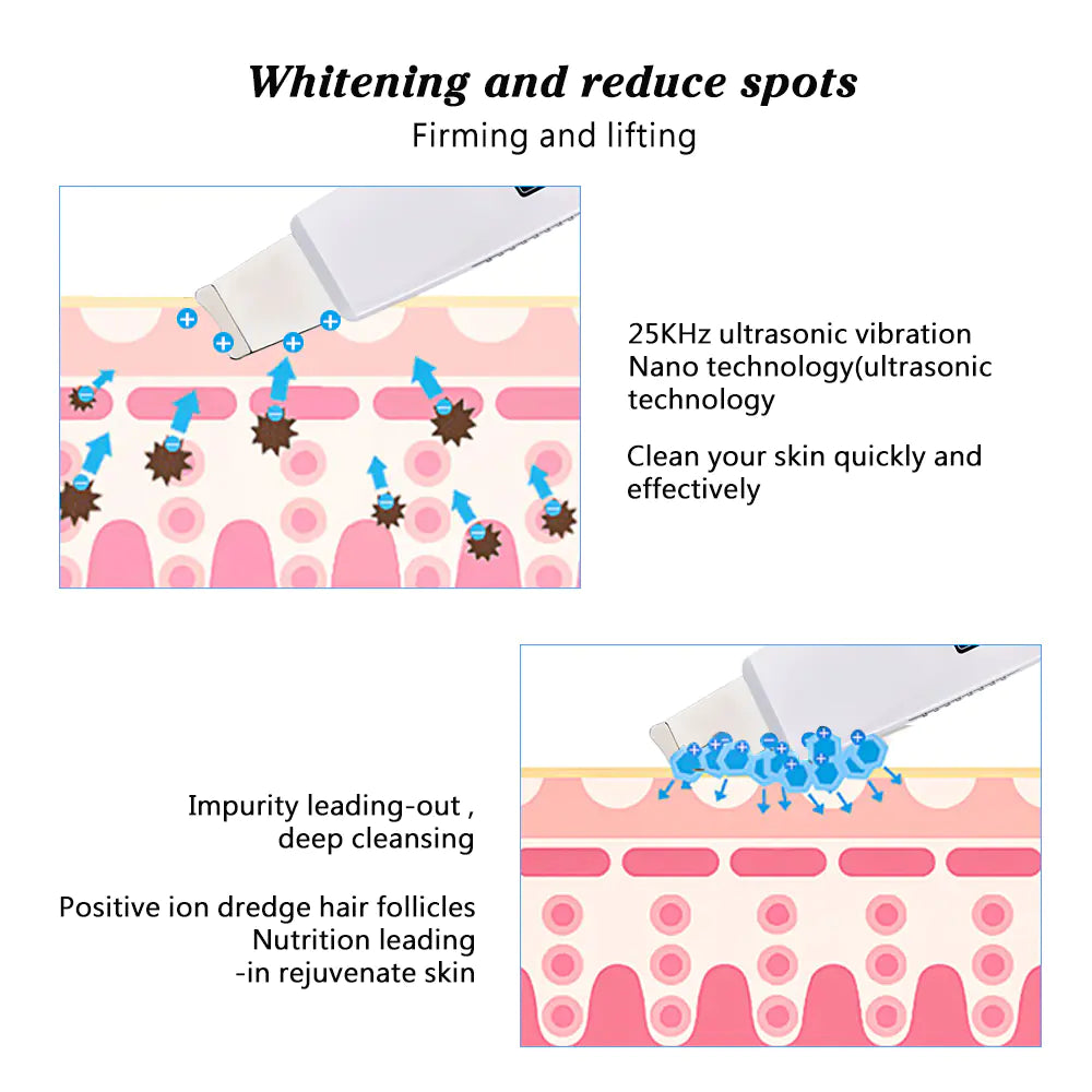 UltraGlow Sonic Facial Cleanser & Pore Vacuum